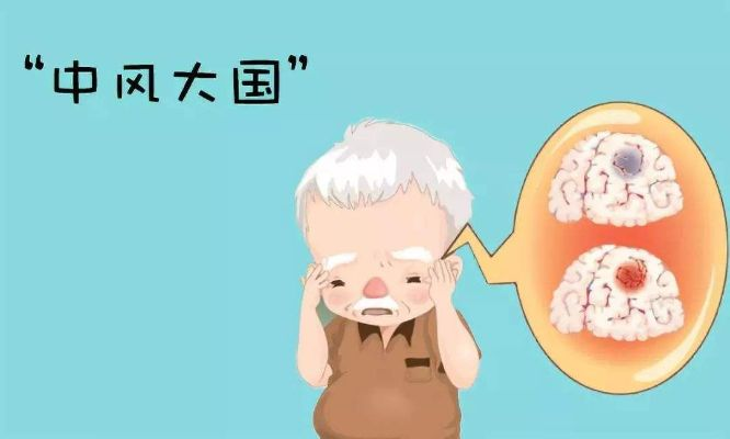 警惕身体的红色警报，脑中风先兆症状是什么